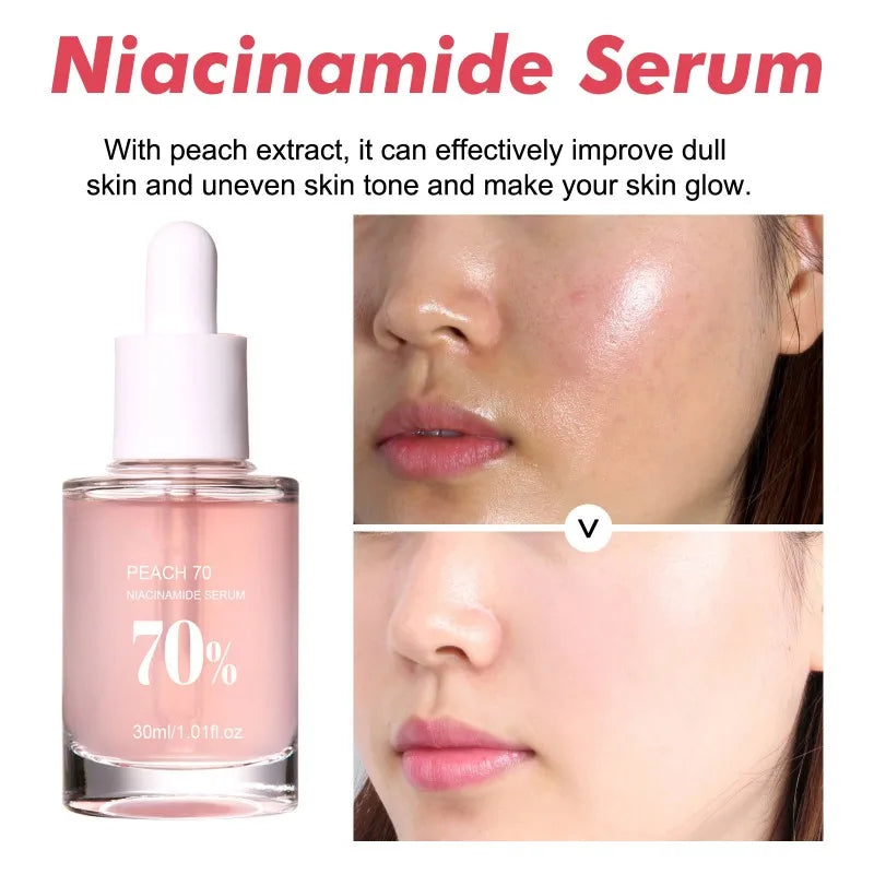 Women Facial Bleaching Serum Moisturizing Fade Dull Melasma Brighten Serum Niacinamide Lighten Essence Fade Fine Lines Skin Care